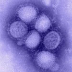 H1N1_influenza_virus