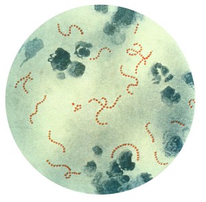 Streptococcus_pyogenes_01